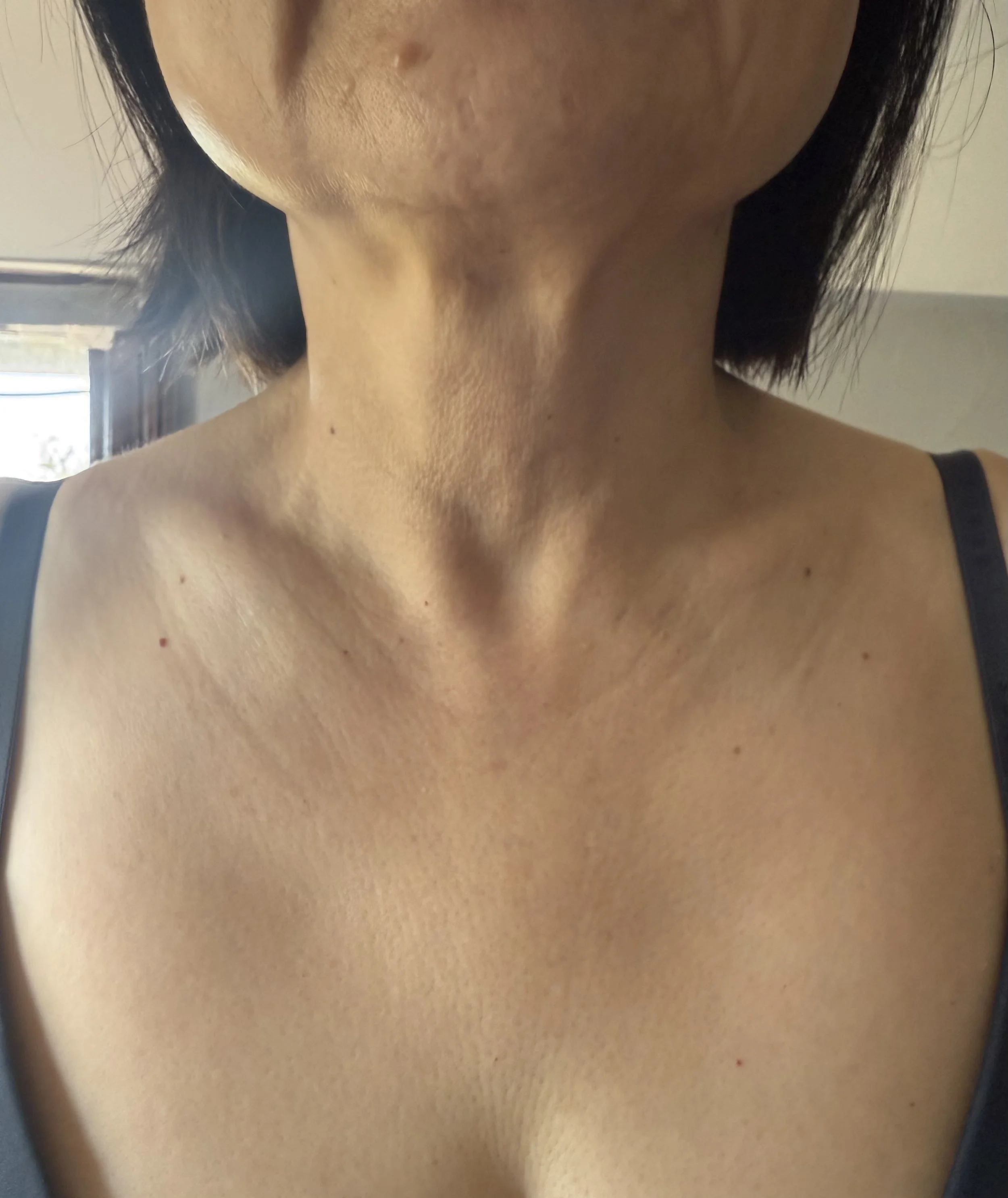 womens neck before treatment 
