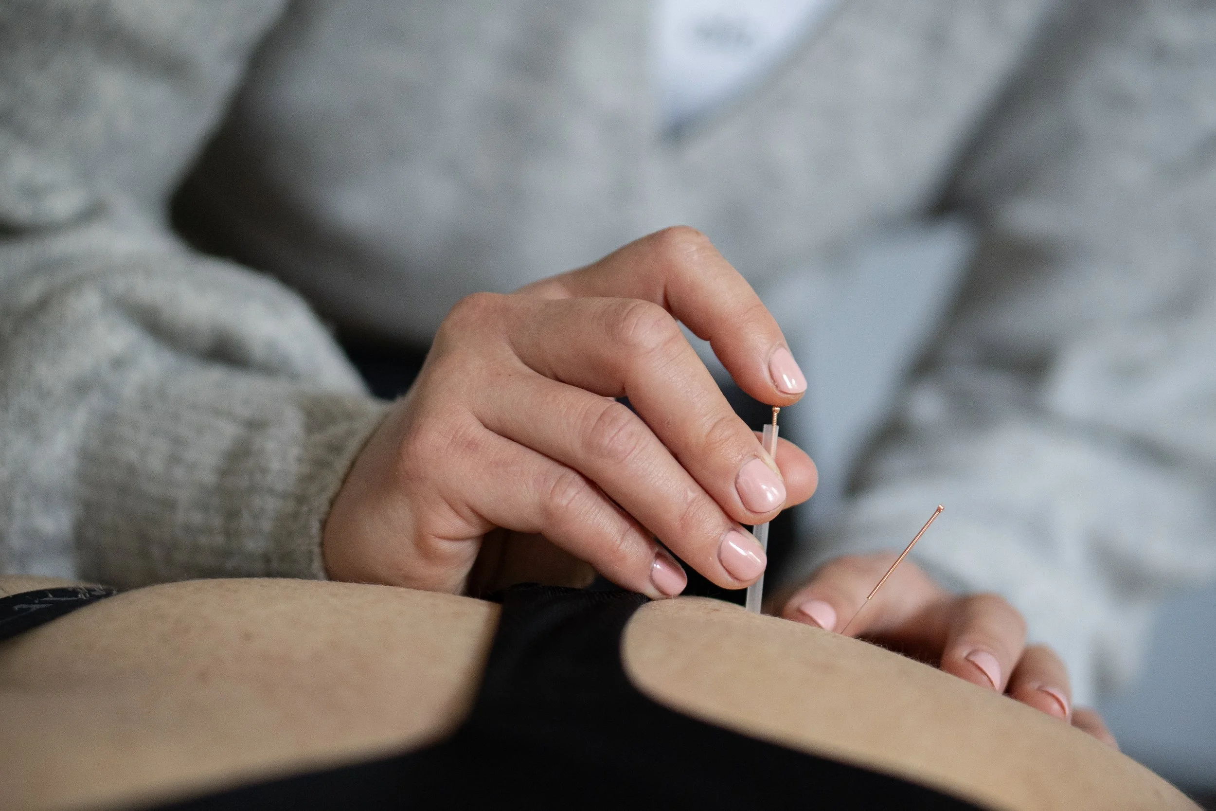Acupuncture in shoulder