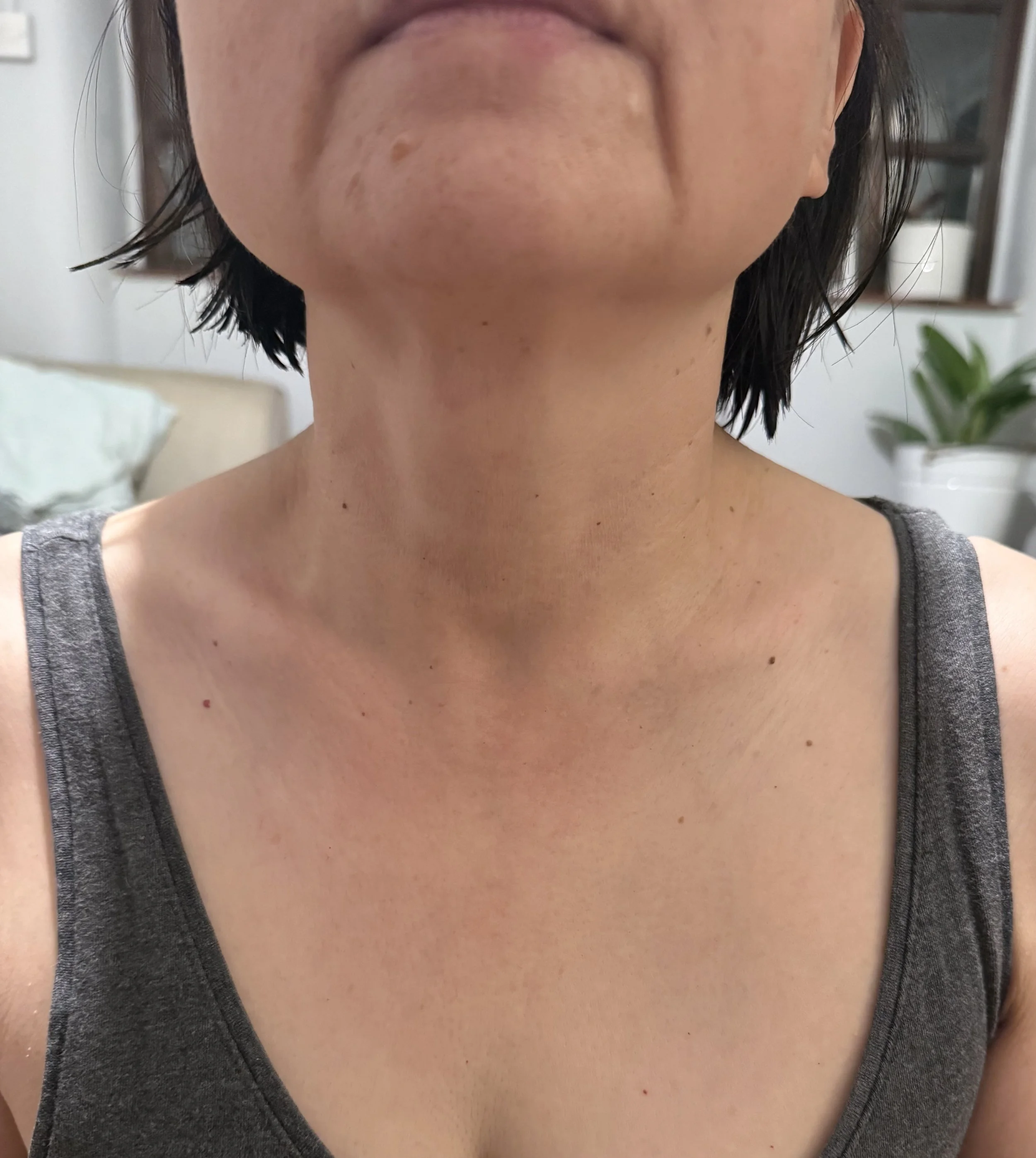 Womens neck after treatment 