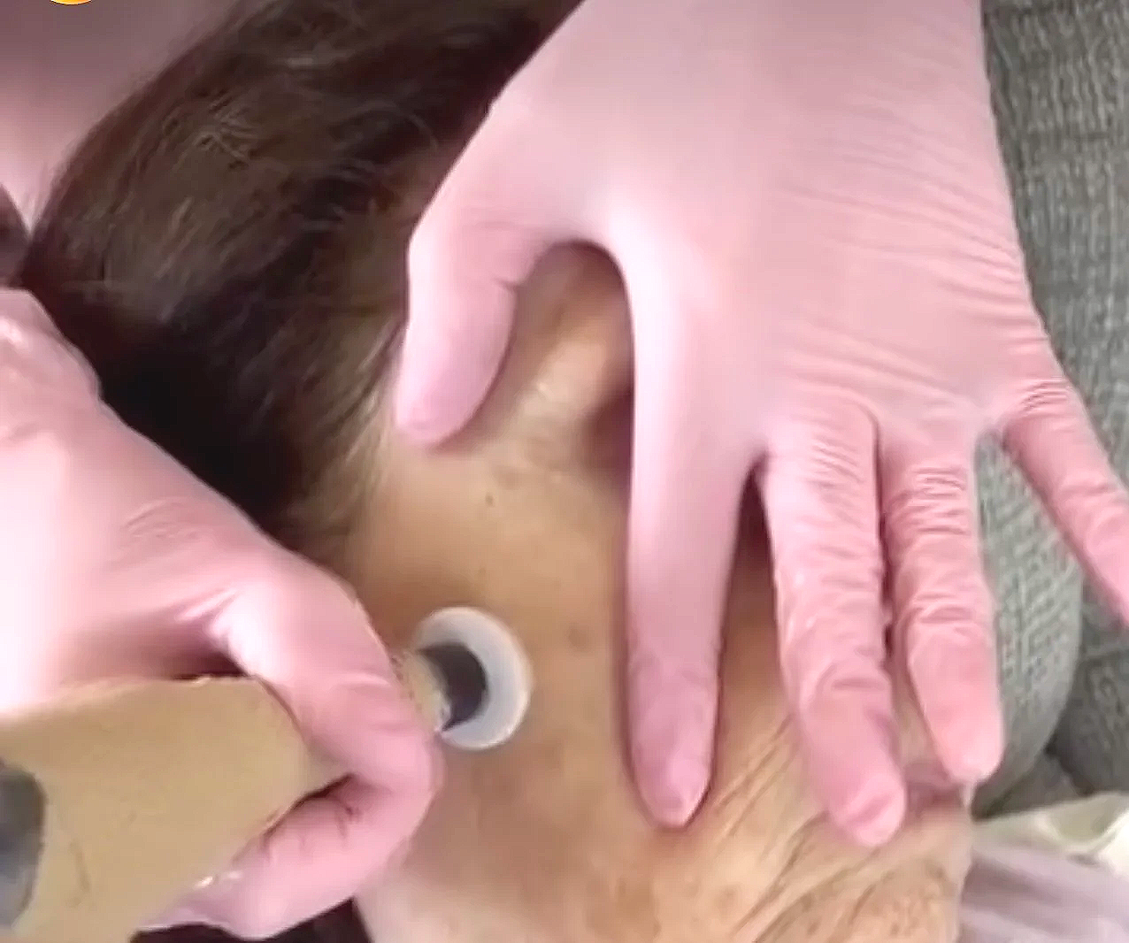 A person receiving an ear piercing from a professional wearing pink gloves in a piercing studio.