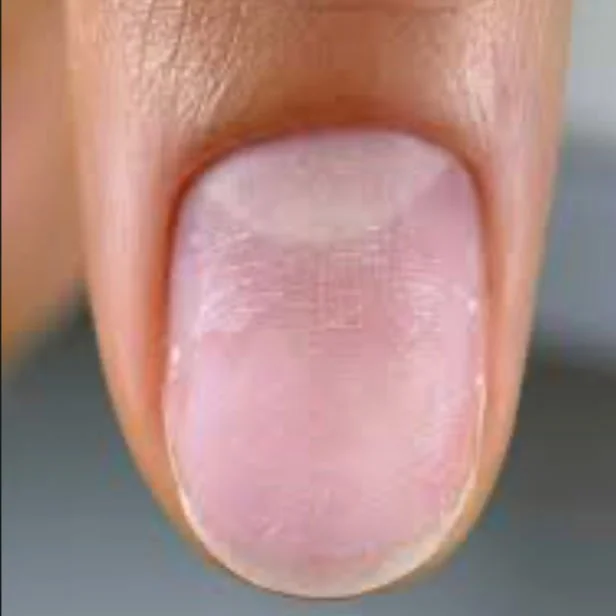 Close-up of a person's fingertip with the fingernail visible.