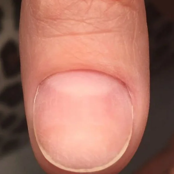 Close-up of a person's thumbnail on their finger.