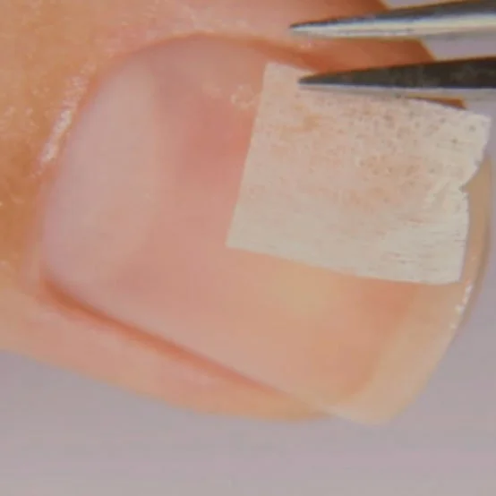 Close-up of a fingernail with a nail patch or sticker being applied with a small pair of tweezers.