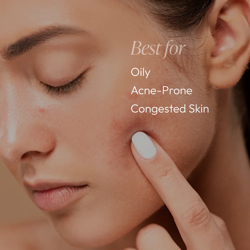 Acne_Essentials_-_11.webp