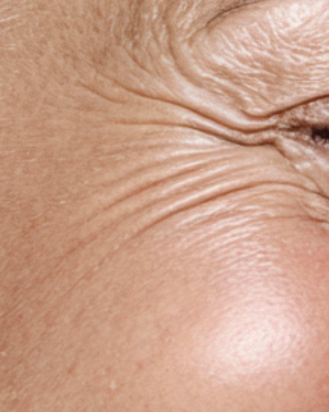 Hautstraffung & Anti Aging