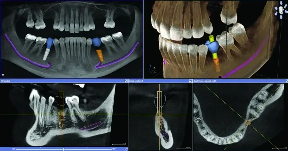 Why we use digital imaging and what it means for you