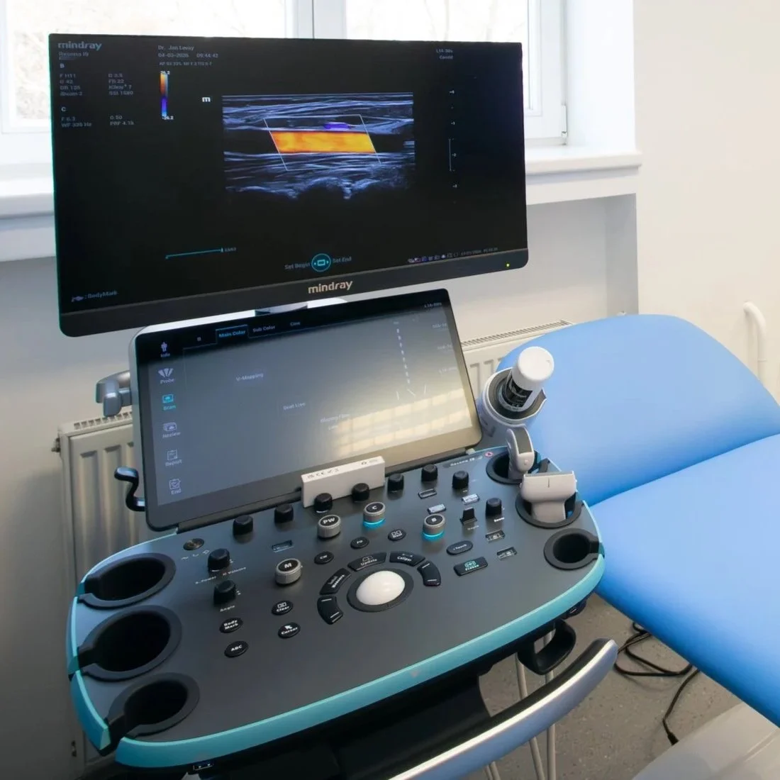 Ako vznikajú kŕčové žily a dá sa im predchádzať?