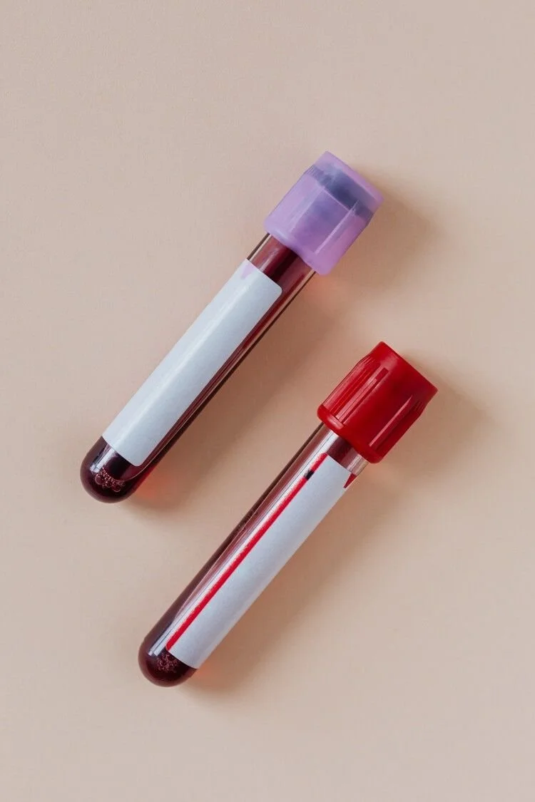 Blood Test Interpretation