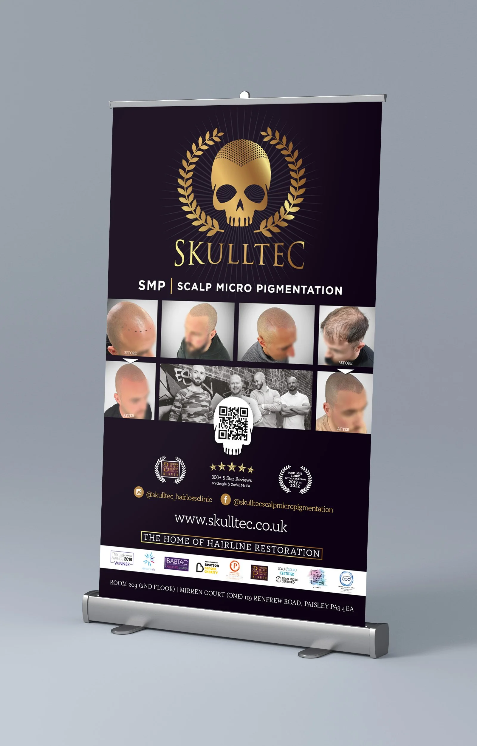 Roll-up banner advertising Skulltec scalp micro pigmentation services. Features logo with skull and laurel wreath, before-and-after photos of clients, QR code, website, social media info, and awards.