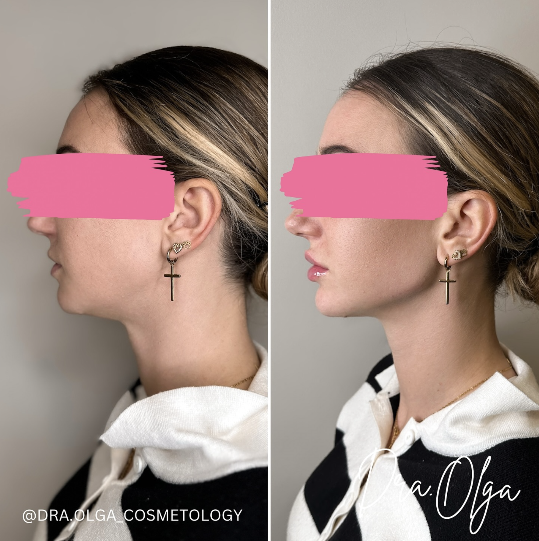 Снимок экрана 2026-03-01 в 00.35.00.png