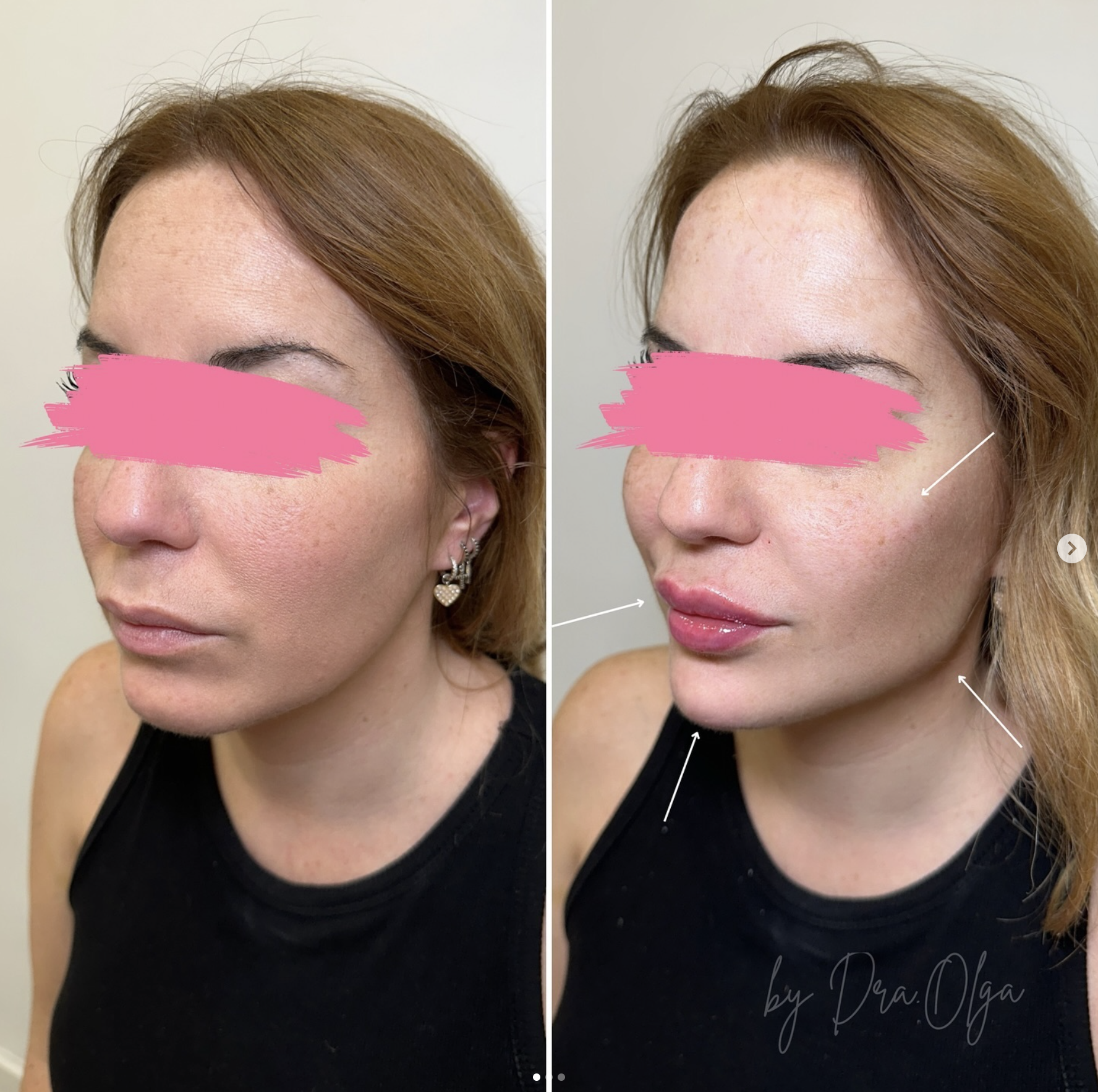 Снимок экрана 2026-03-02 в 23.57.40.png