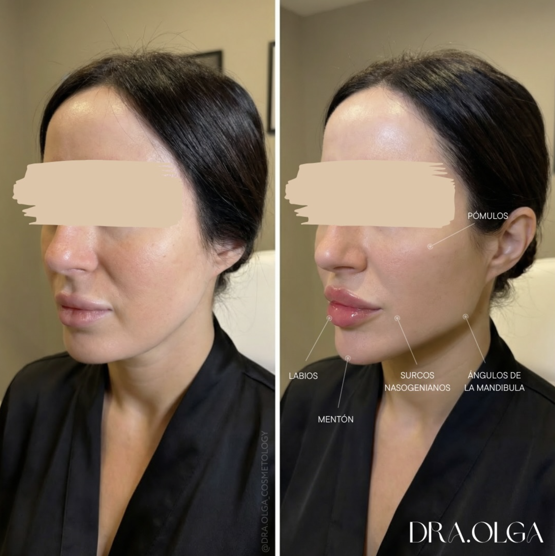 Снимок экрана 2026-03-01 в 00.33.52.png