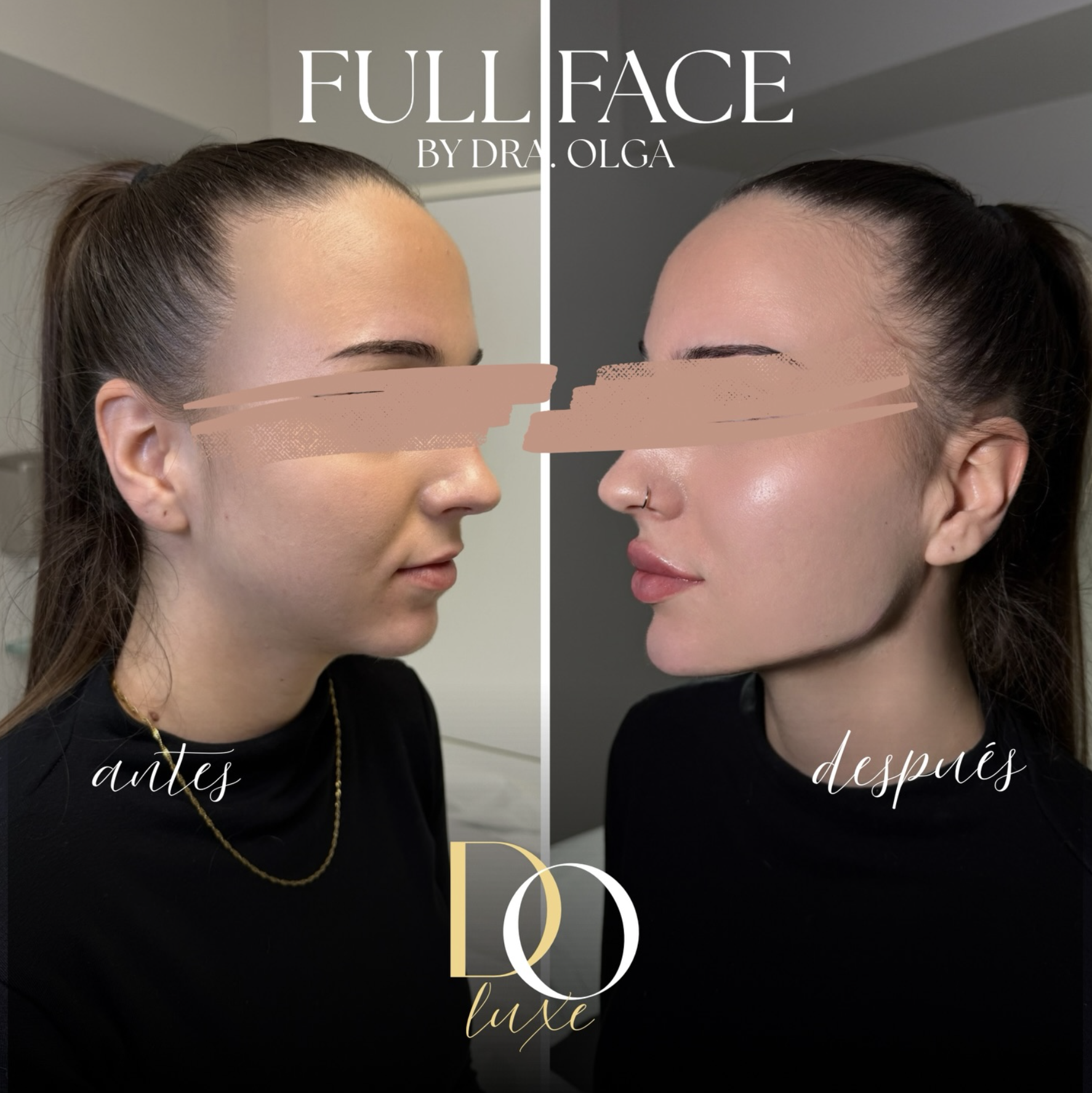 Снимок экрана 2026-03-01 в 00.32.45.png