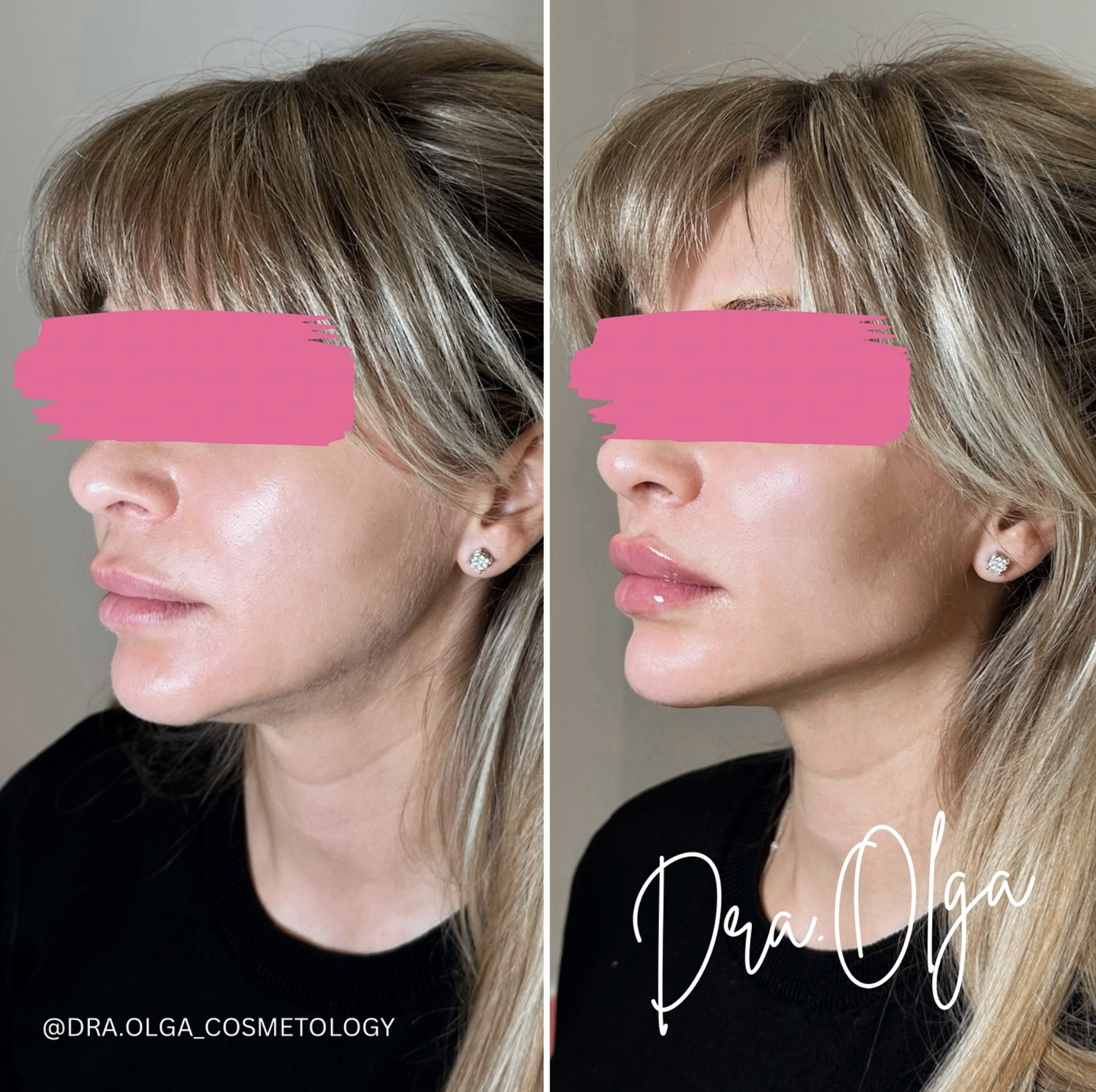 Снимок экрана 2026-03-01 в 00.34.50.png