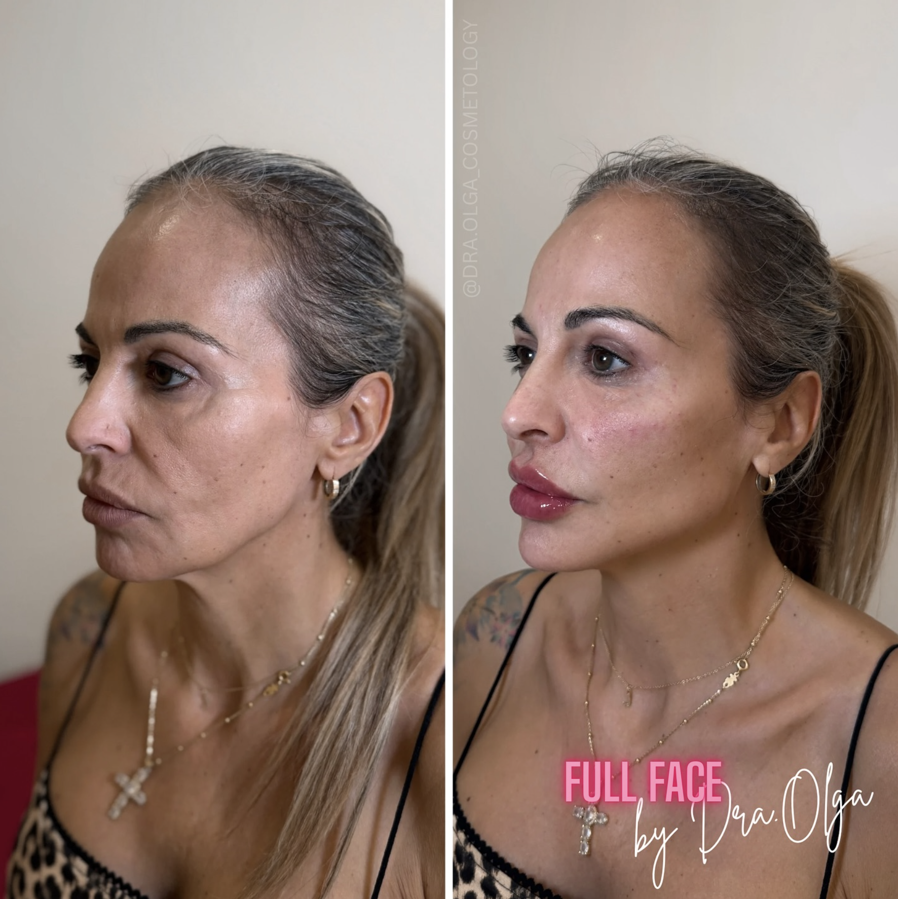 Снимок экрана 2026-03-02 в 23.55.52.png