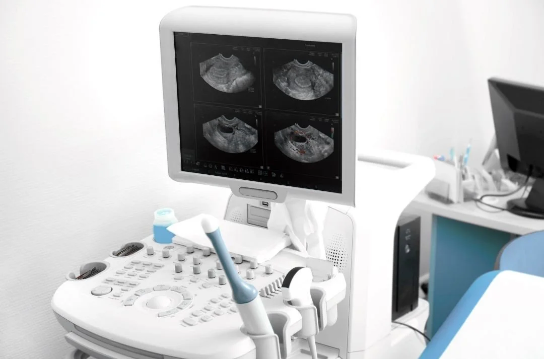 Transvaginal ultrasound scan for fertility investigations