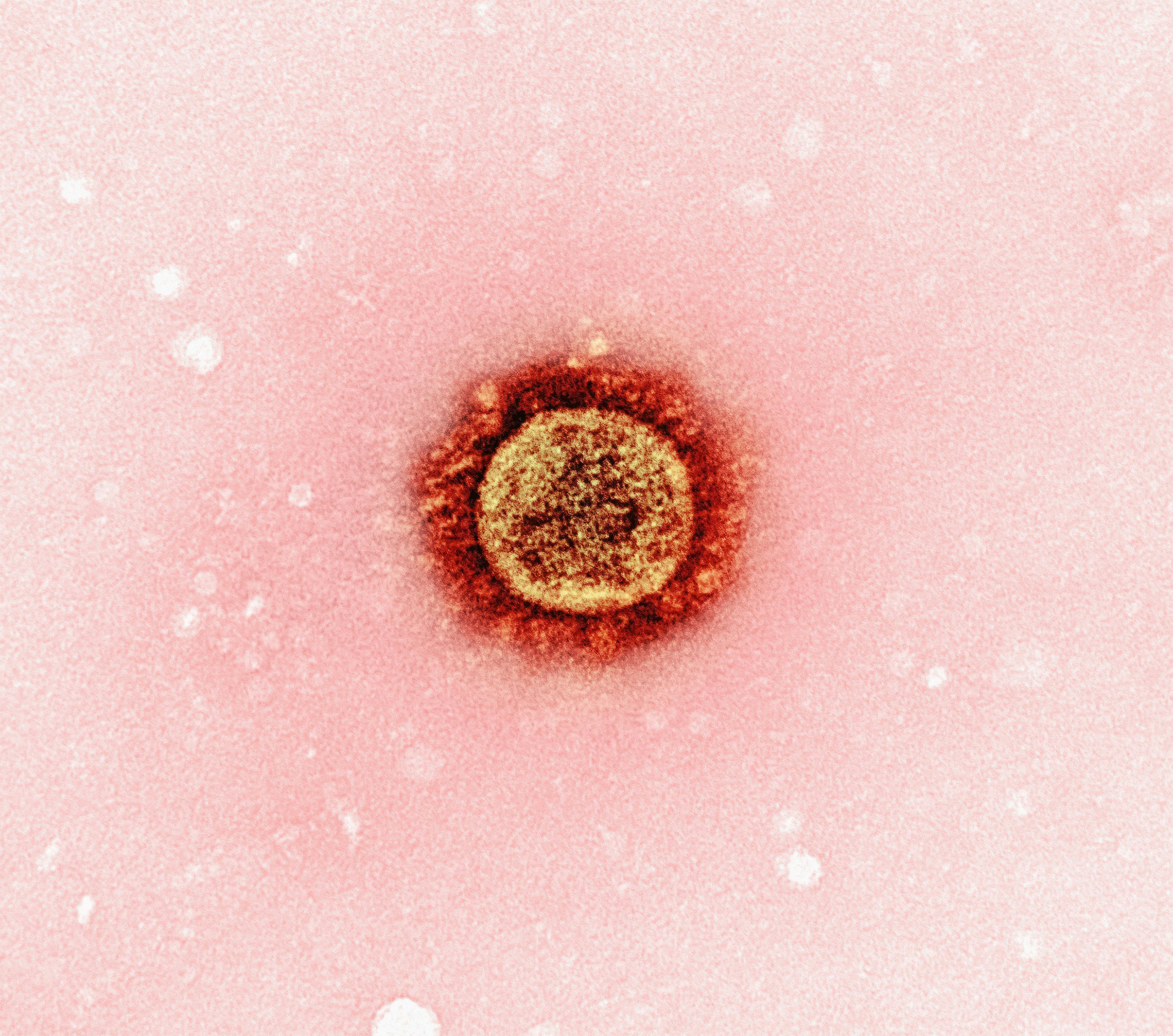 Close-up view of a viral particle, possibly a coronavirus, with a pink background and small white specks.