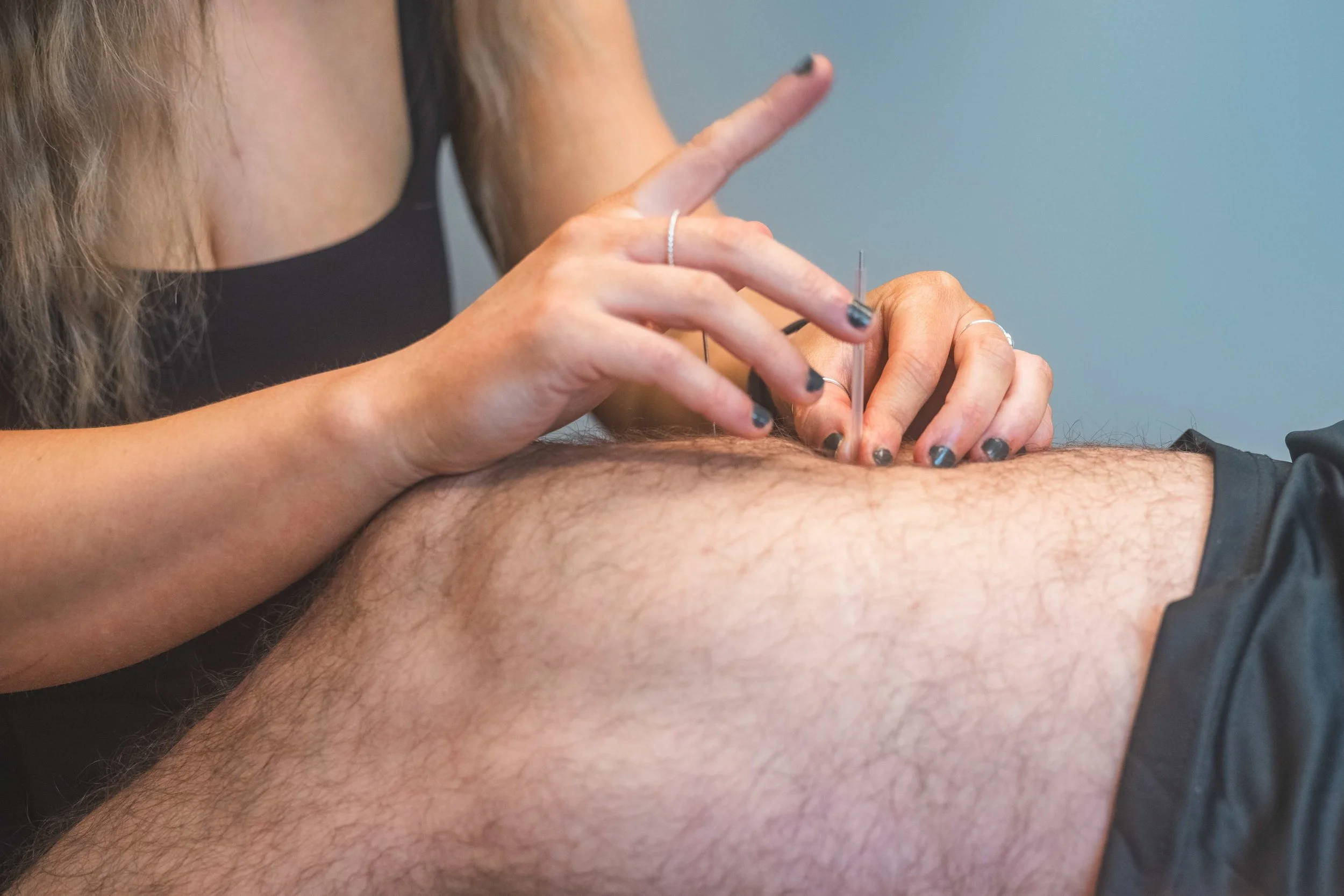 Acupuncture Regina, Chiropractor, Cowell