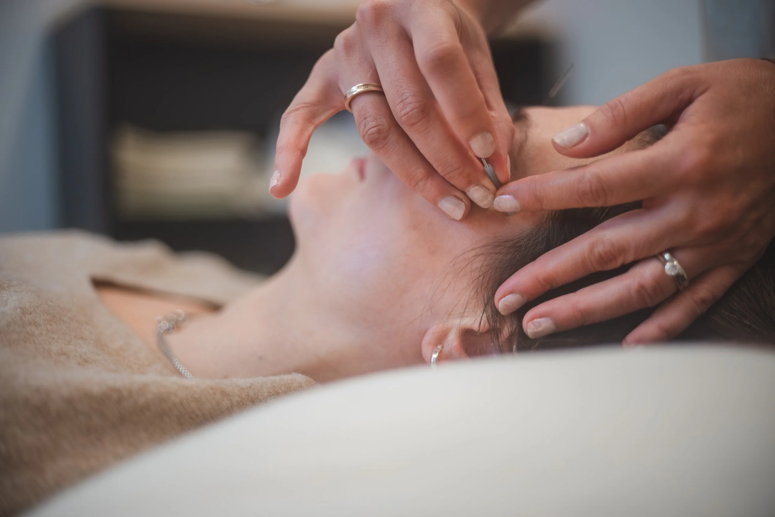 Client receiving a gentle and relaxing facial acupuncture  treatment in Regina.