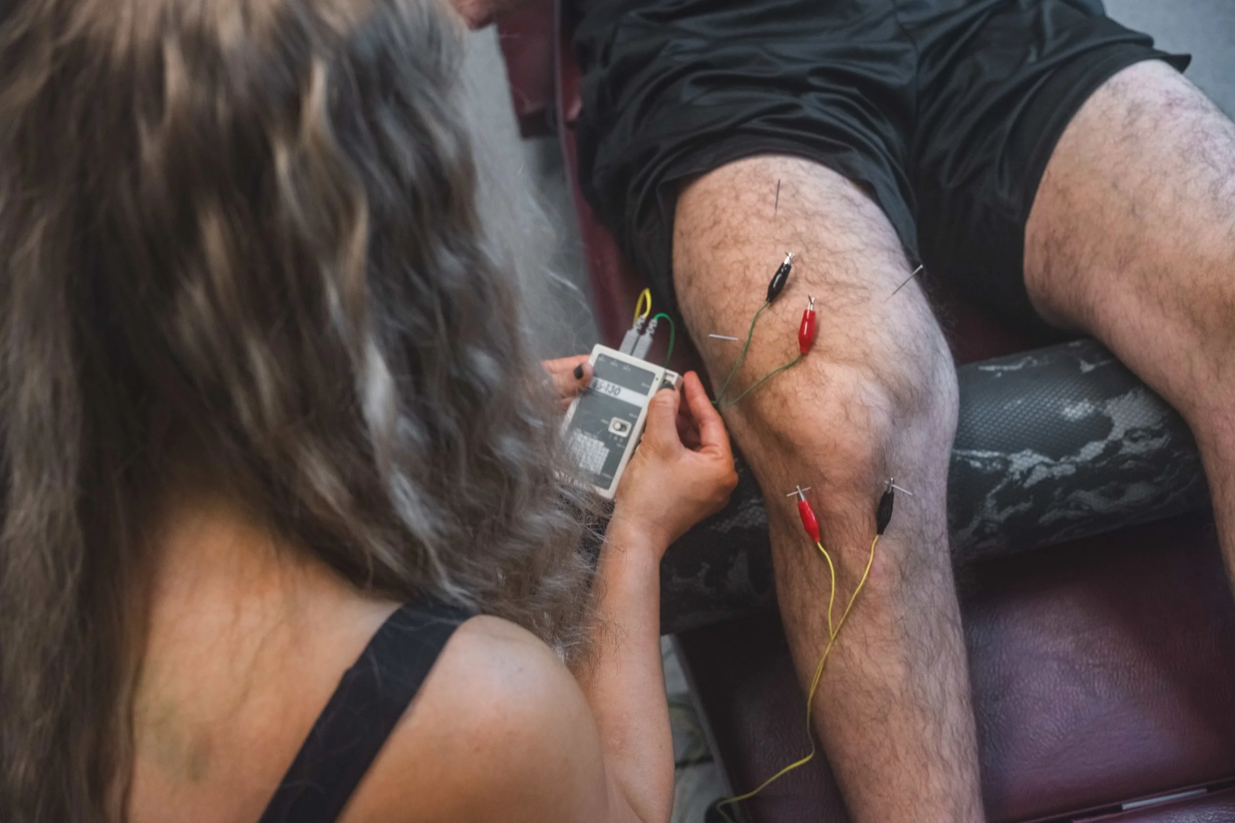 Acupuncture in Regina, Electronic acupuncutre