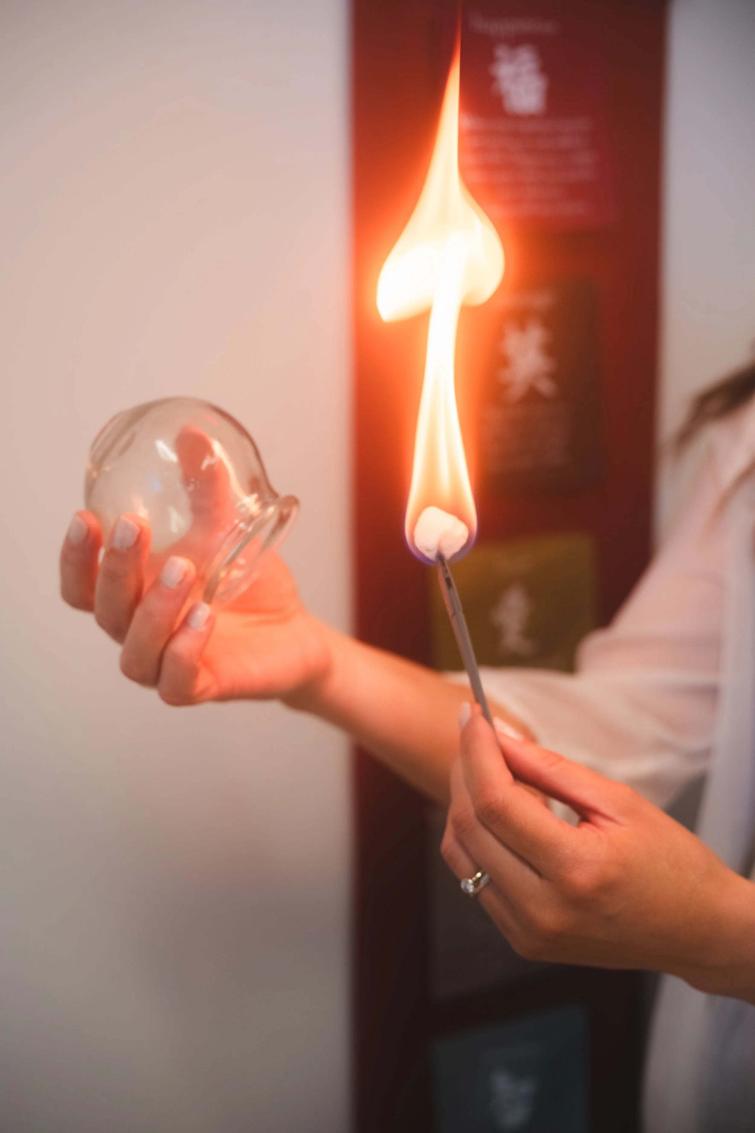 Cupping therapy done by Acupuncturist in Regina.