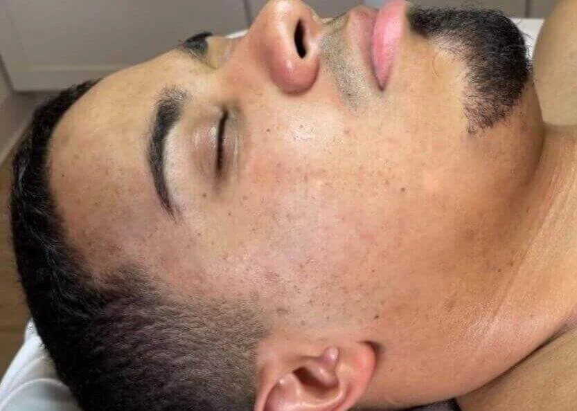 Close-up of a man's face lying stocked with his eyes closed, showing facial hair, closed eyelid, and skin texture.