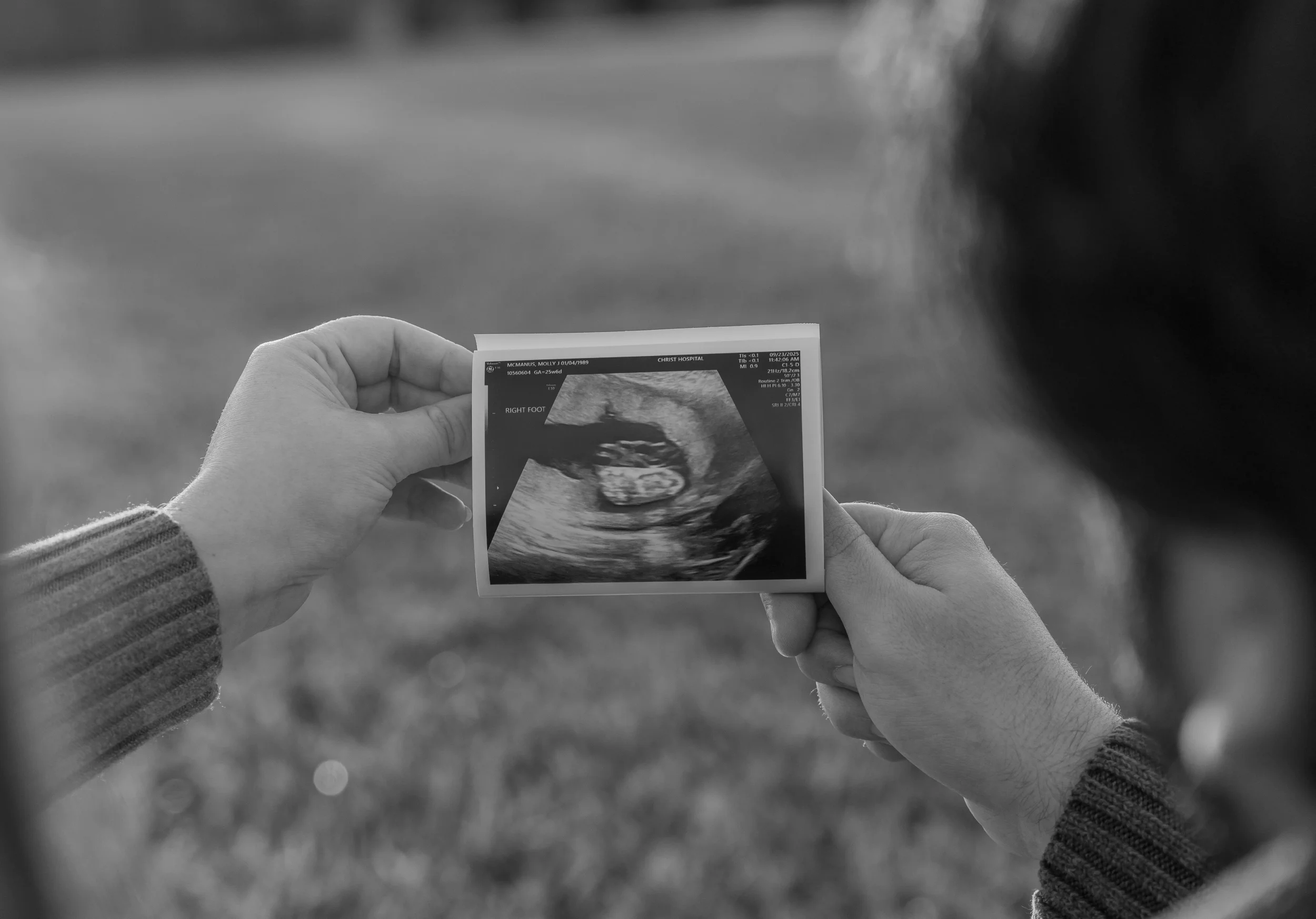 Husband and wife looking at baby ultrasound