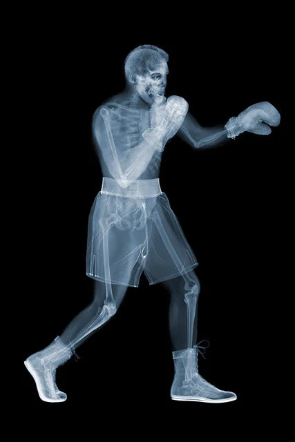Muhamad Ali 2015 X-ray photography printed on C-Type and mounted on Diasec Signed by artist [67 x 47”] [33 x 23”] Inquire