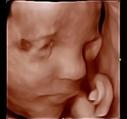 Close-up of a baby's face with closed eyes and hand near the mouth.