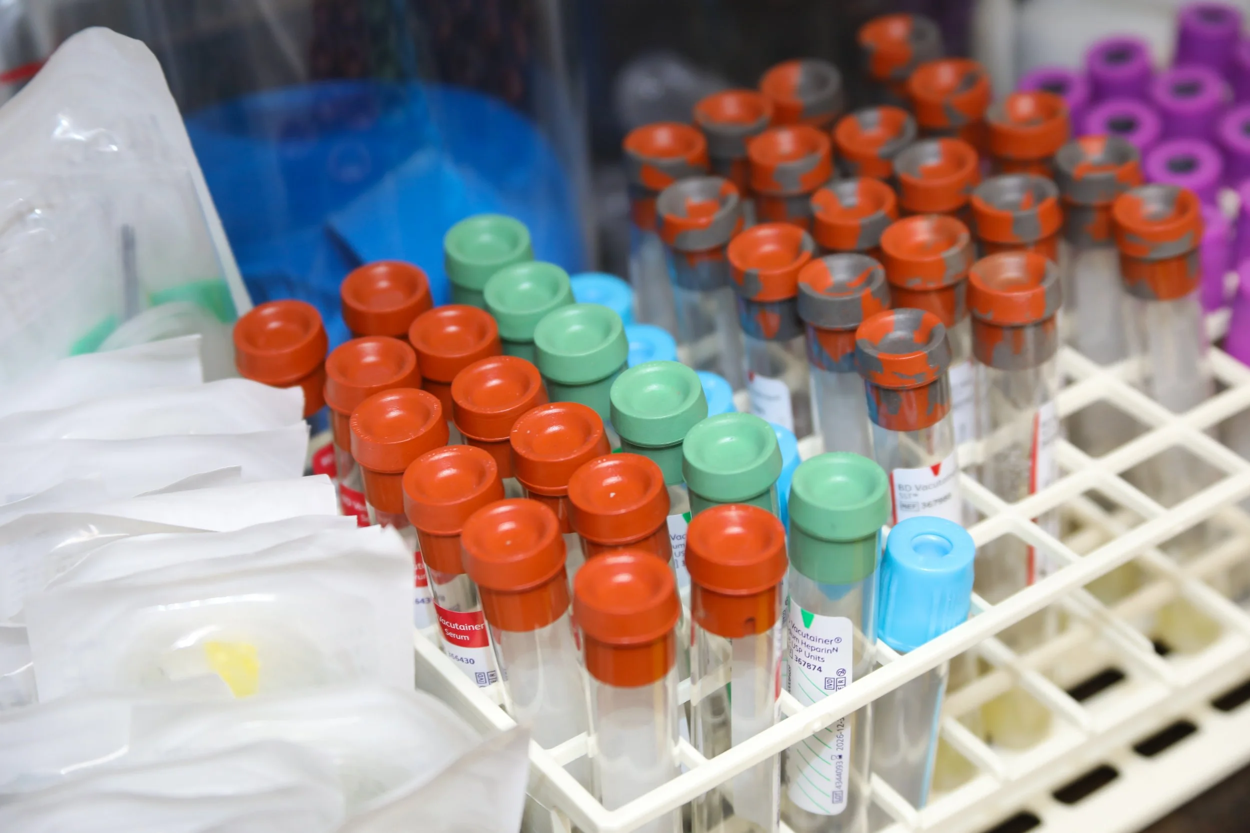 Multiple laboratory test tubes with red, green, blue, and gray caps arranged in a rack.