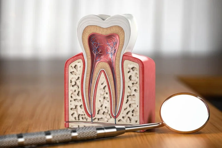 Tooth cross section showing pulp and infection