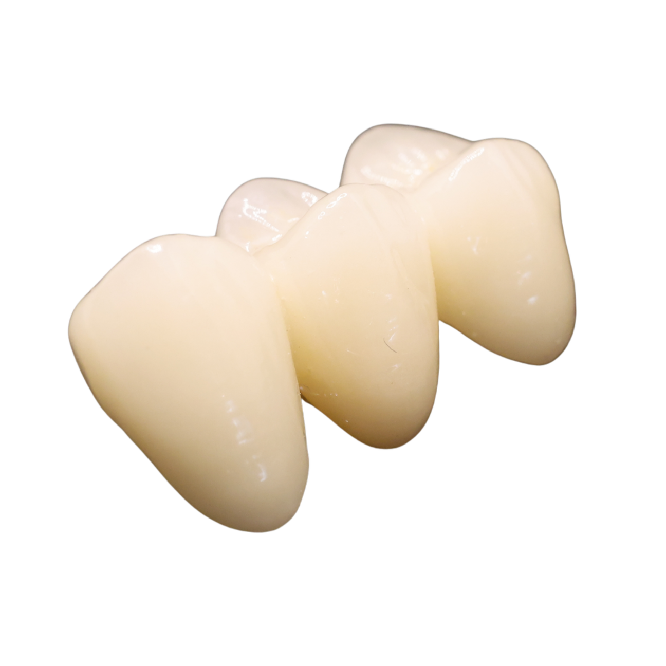 A close-up of a dental bridge showing three connected artificial teeth with a smooth, off-white surface against a black background.