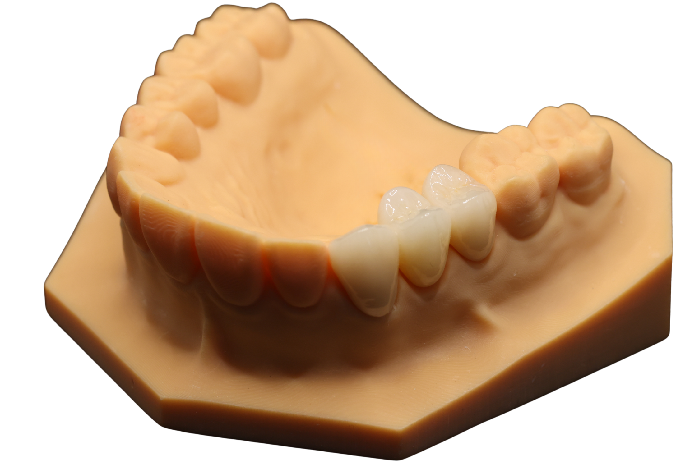 A dental wax model showing a row of teeth, including molars, premolars, and front teeth.