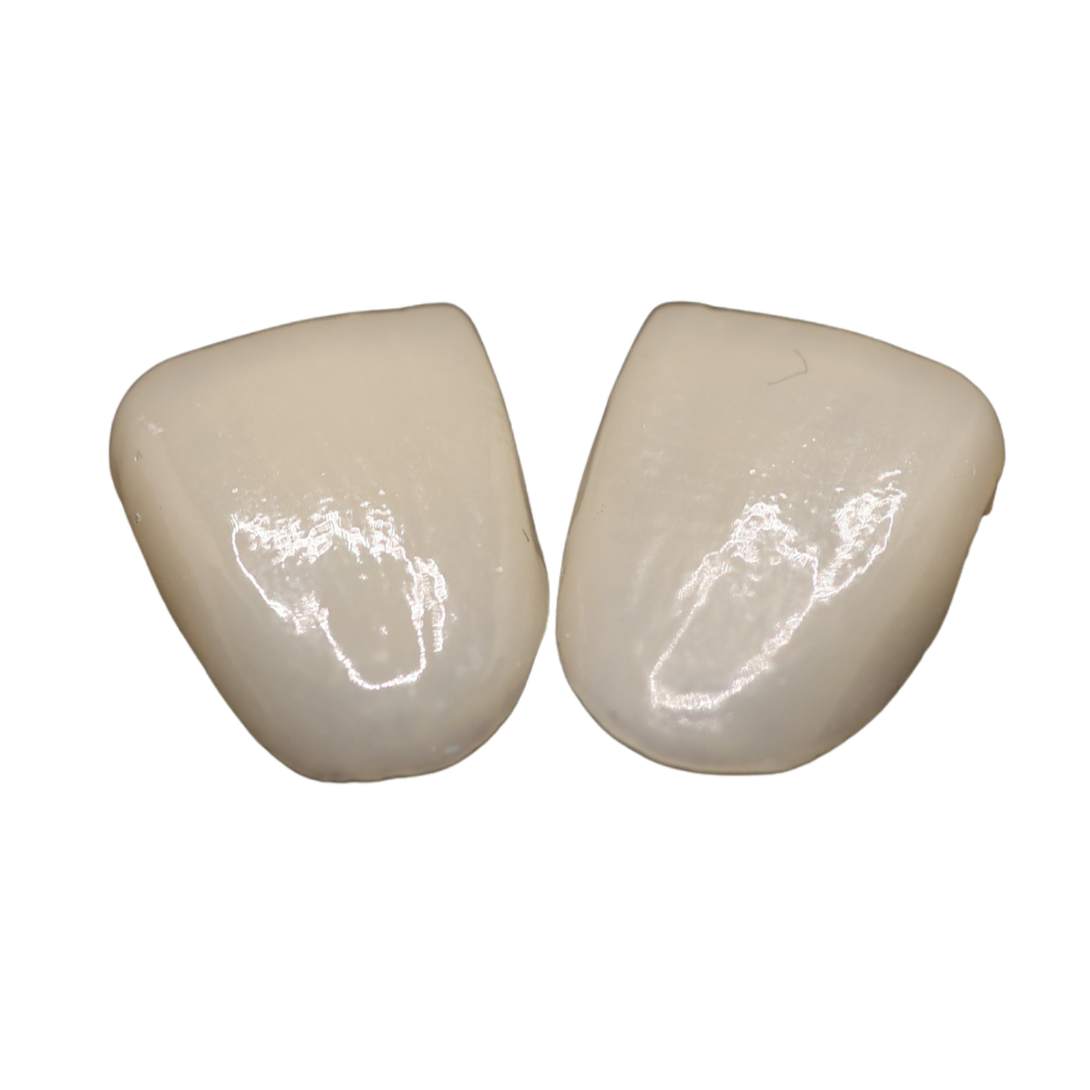Two white teeth with a glossy surface, placed side by side on a black background.