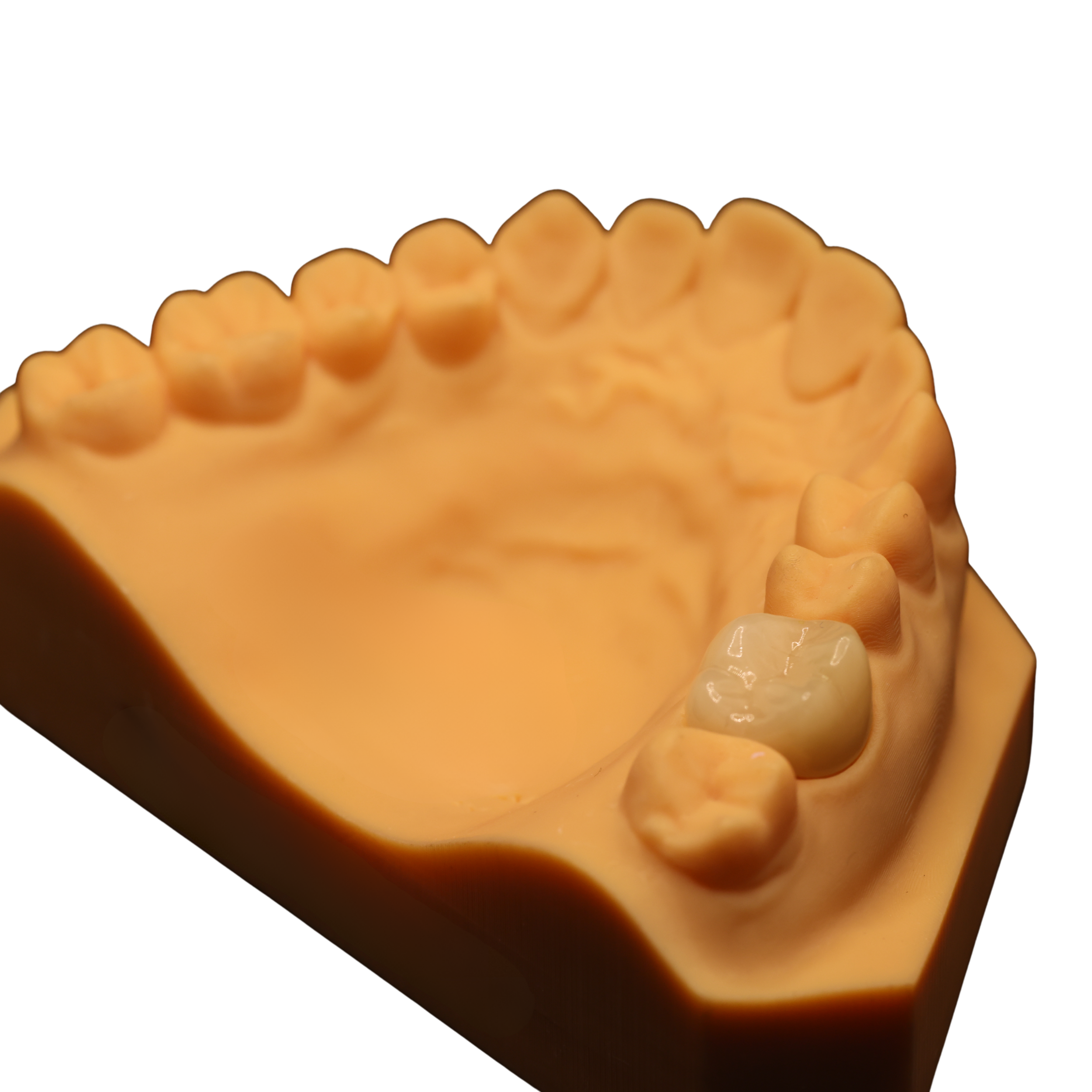 A dental model of the upper jaw showing teeth, with one tooth made of white material.