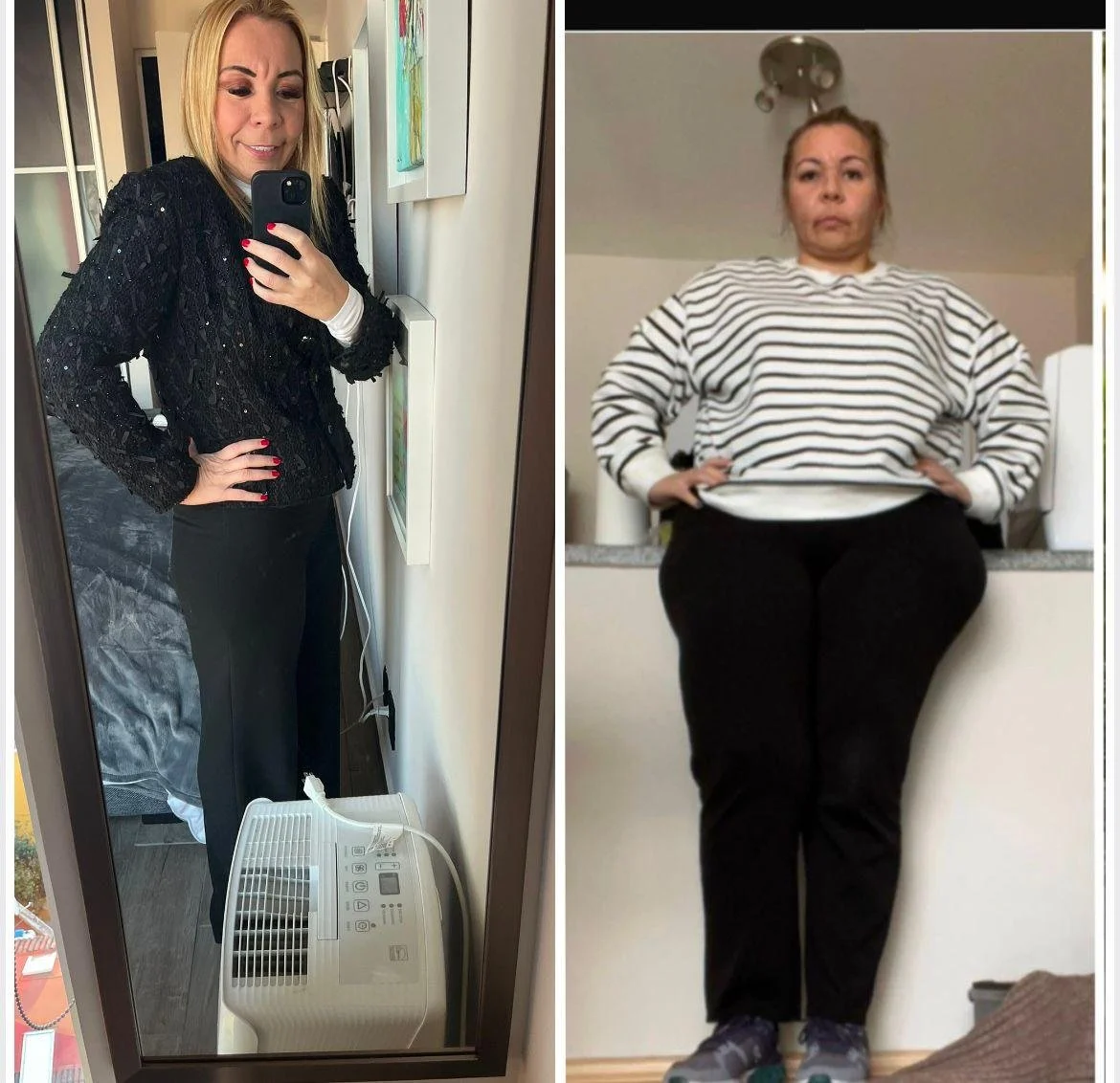 Imagen comparativa de una mujer en la izquierda con apariencia delgada, tomando una selfie en un espejo, y en la derecha la misma mujer con apariencia con más peso, vestida con camiseta de rayas, en un entorno interior.