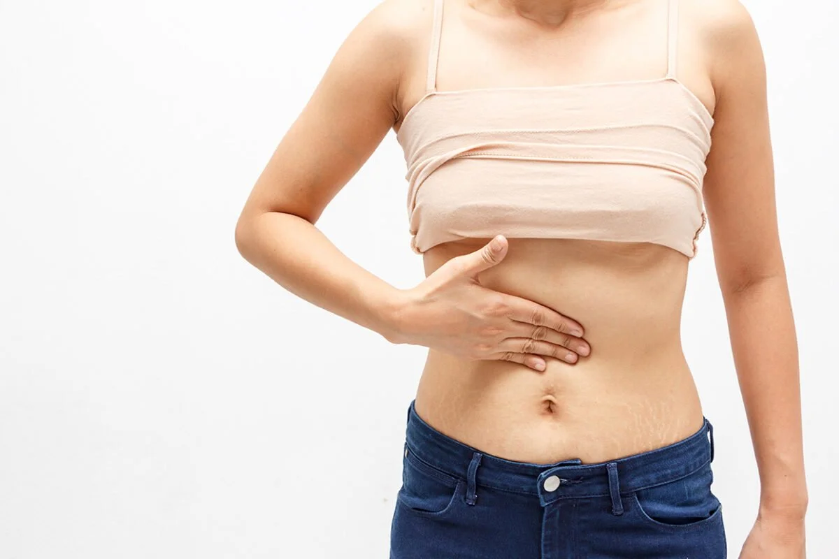 Alimentación en colon irritable