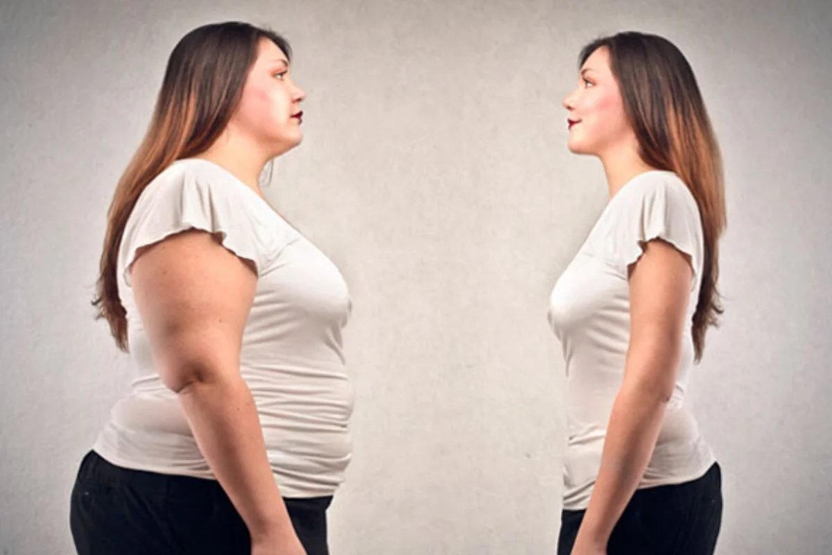 Tratamiento de obesidad