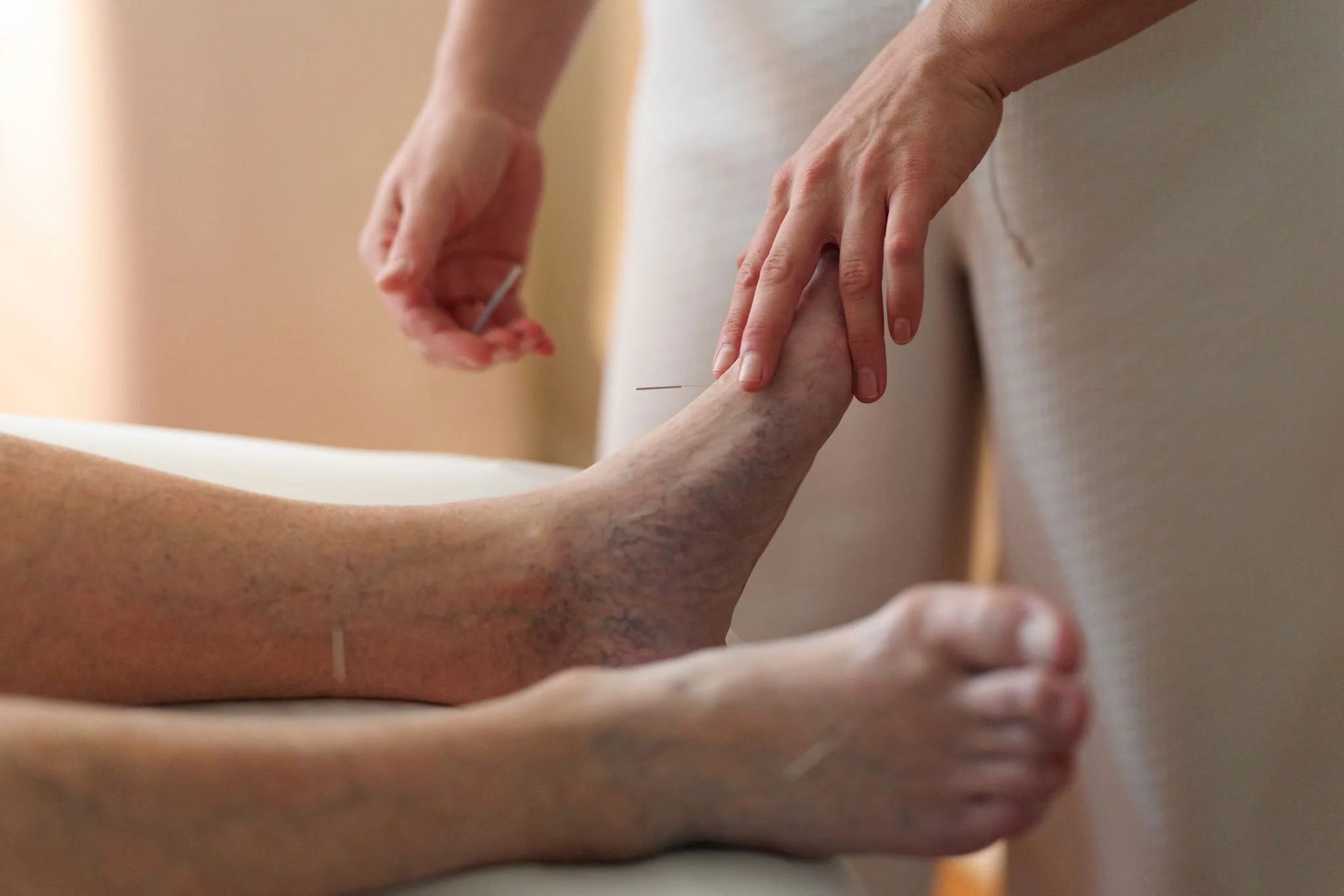  An elderly man receives acupuncture at Nourish &amp; Move Wellness Studio in Mt. Lebanon, PA. Acupuncture can help relieve chronic pain, regulate the nervous system, reduce stress, and support overall well-being. 