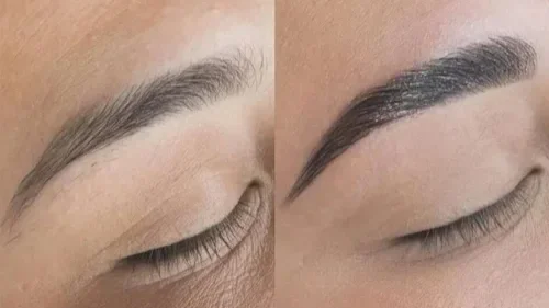 Brow enhancement before and after in Ogden Utah