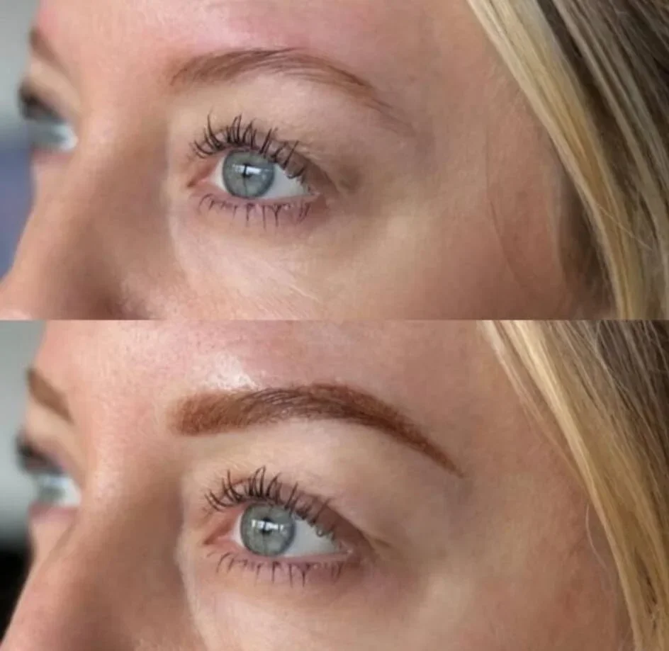 Brow enhancement before and after in Ogden Utah