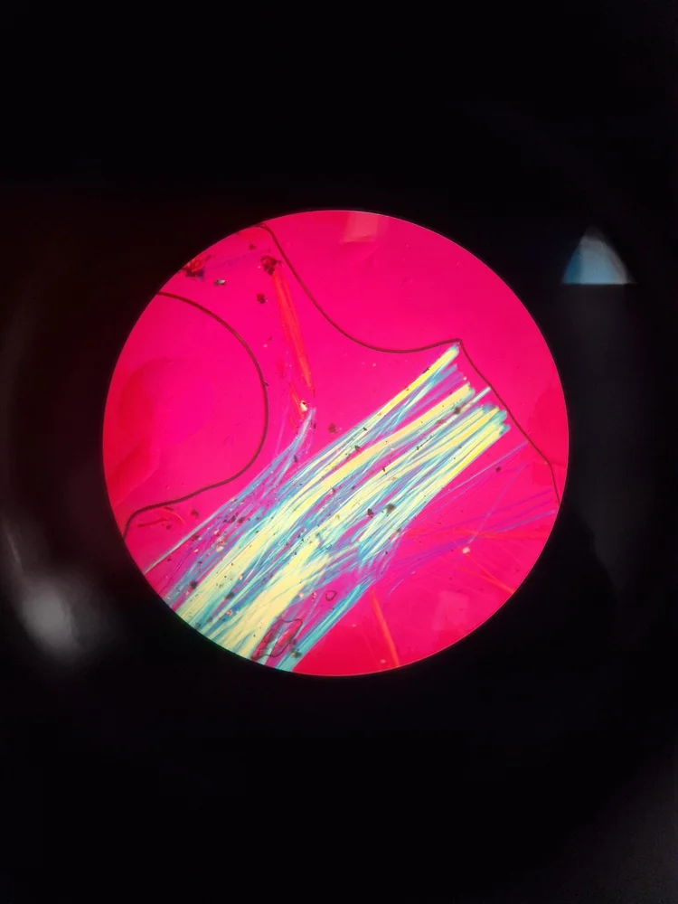 Asbestos fibres viewed during laboratory polarised light microscopy analysis