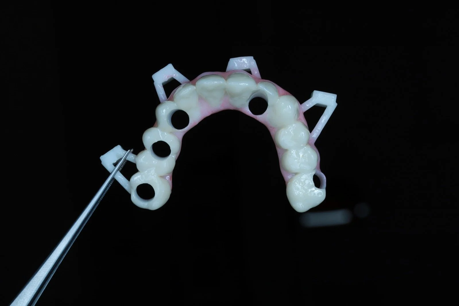 A dental model showing a partial upper arch with mounted dental implants, held by dental tweezers against a black background.