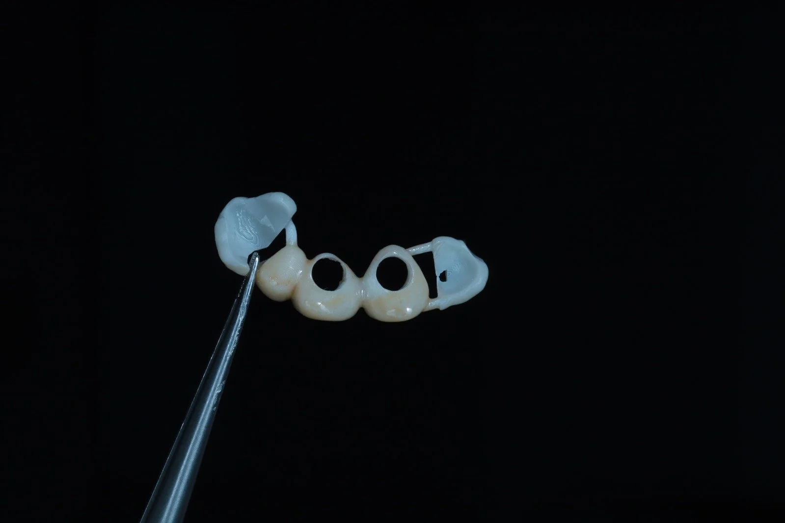A dental prosthetic with four artificial teeth connected by metal links, held by a pair of dental tweezers against a black background.