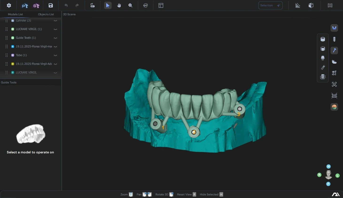 A digital 3D model of a dental prosthesis, specifically a lower jaw implant with artificial teeth, shown on a computer screen within a 3D modeling software interface.