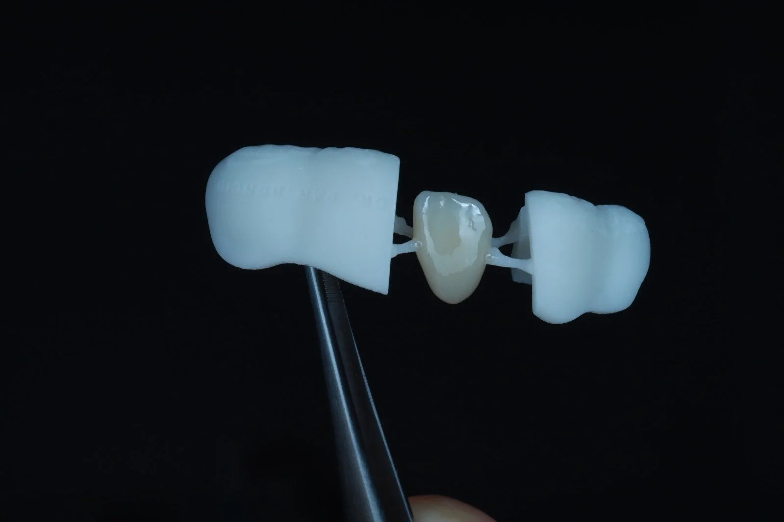Close-up of a dental bridge with a dental crown in the center, held by a dental tool against a black background.