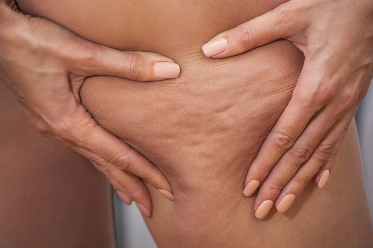 Close-up of a person's hands forming a heart shape on their thigh, showing skin with some stretch marks.