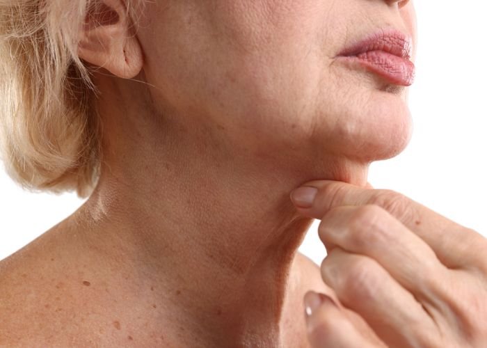 Close-up of a woman with light skin, touching her chin with her hand, showing the side of her face and neck.