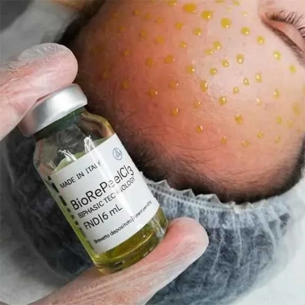A medical professional holds a small vial of biorevitalization solution above a patient's forehead, which is marked with many small yellow dots, likely for a cosmetic procedure.