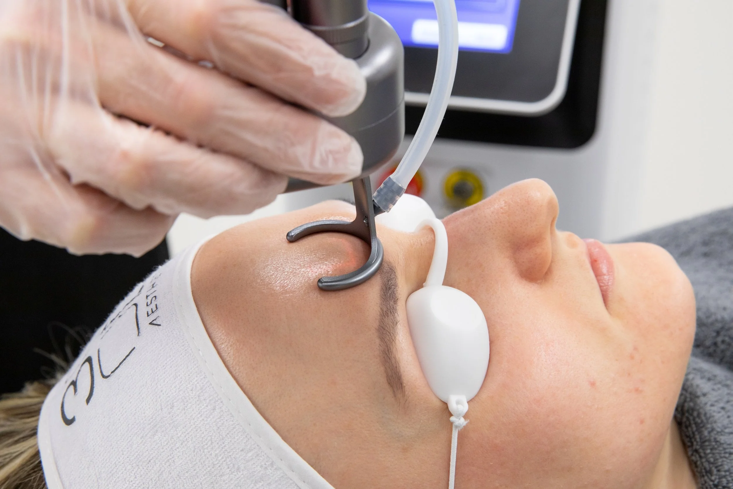 A person receiving a facial treatment with a medical device on their forehead, wearing eye protection and lying on a treatment table.